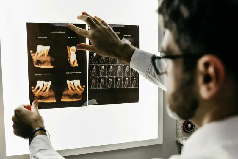 Implantes dentales